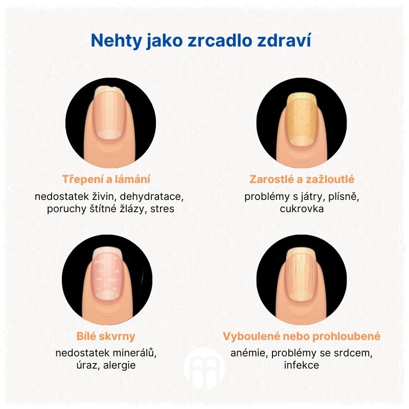 Nehty jako zrcadlo zdraví